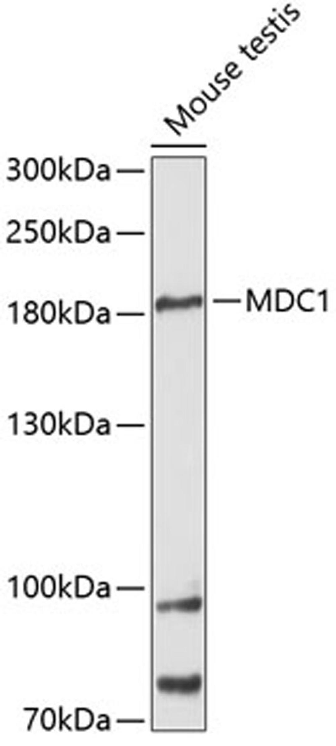 Western blot - MDC1 antibody (A12714)