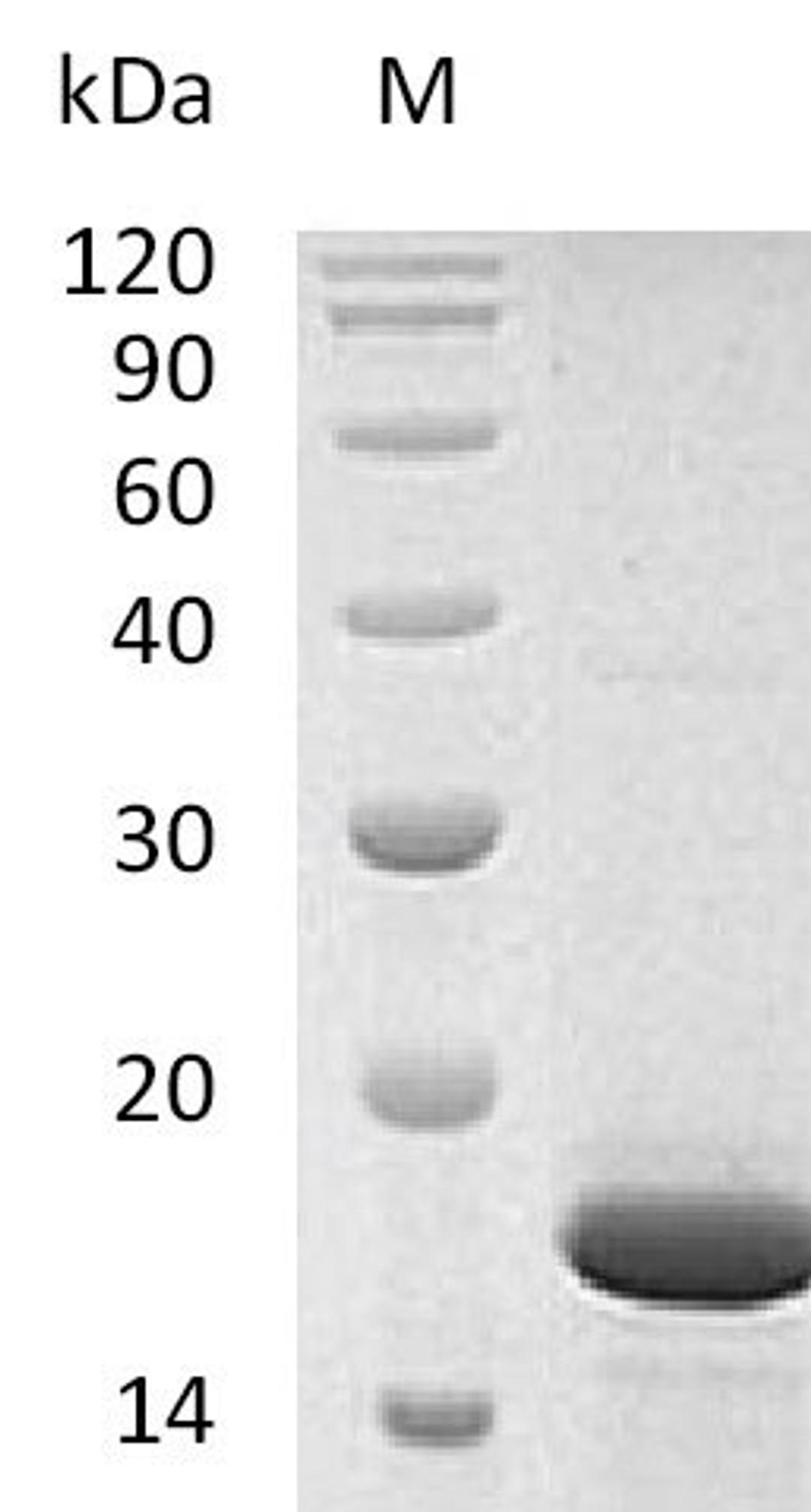 (Tris-Glycine gel) Discontinuous SDS-PAGE (reduced) with 5% enrichment gel and 15% separation gel.