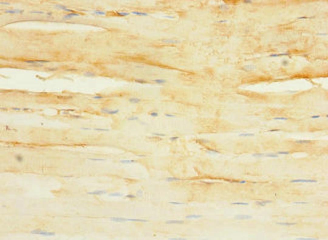 Immunohistochemistry of paraffin-embedded human skeletal muscle tissue using CSB-PA672077LA01HU at dilution of 1:100