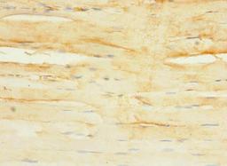 Immunohistochemistry of paraffin-embedded human skeletal muscle tissue using CSB-PA672077LA01HU at dilution of 1:100