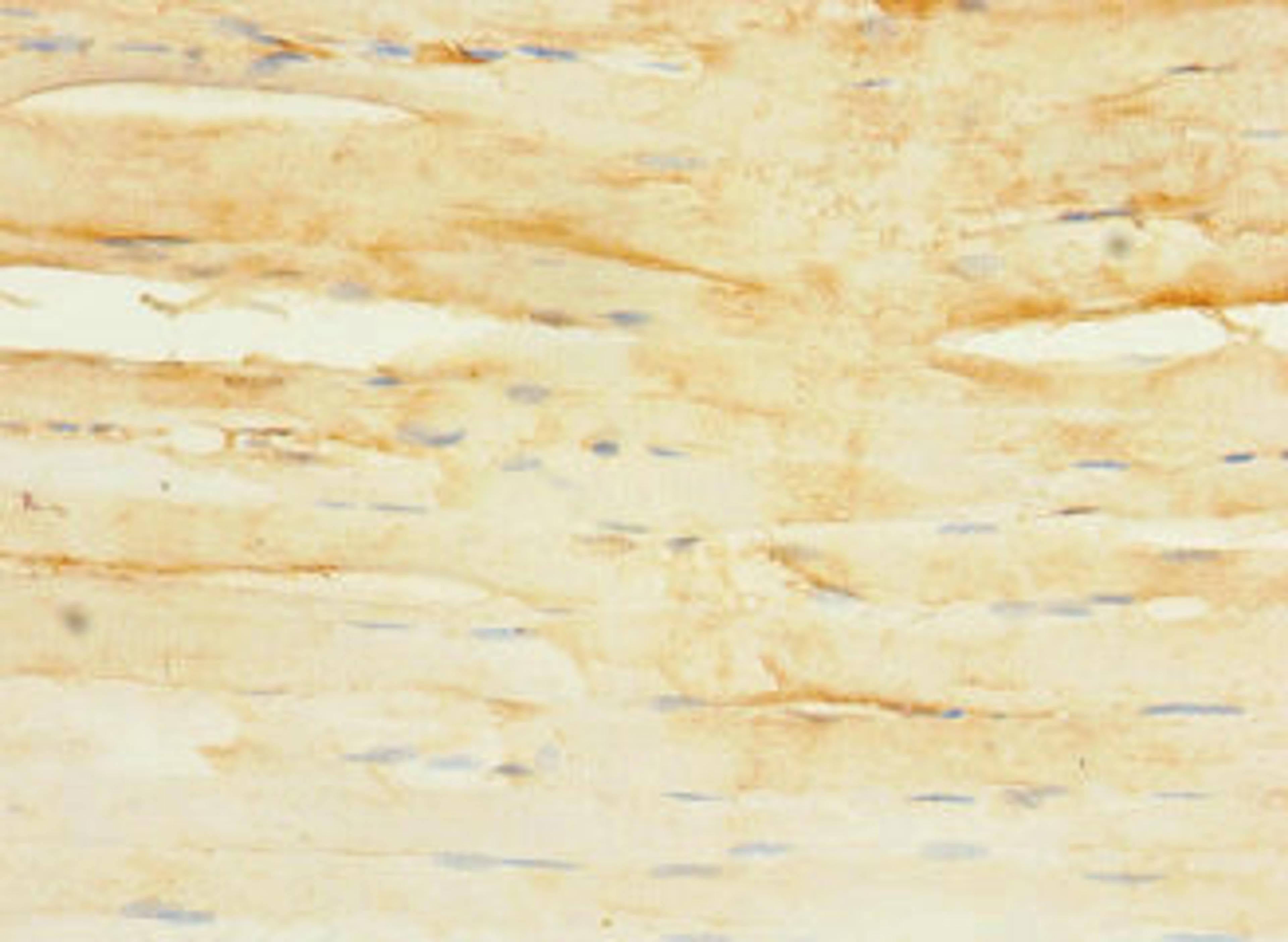 Immunohistochemistry of paraffin-embedded human skeletal muscle tissue using CSB-PA672077LA01HU at dilution of 1:100