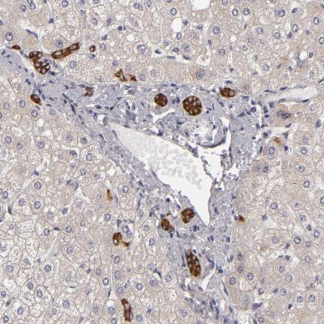 Immunohistochemistry: EFS Antibody [NBP2-31993] - Staining of human liver shows strong cytoplasmic and membranous positivity in bile duct cells.