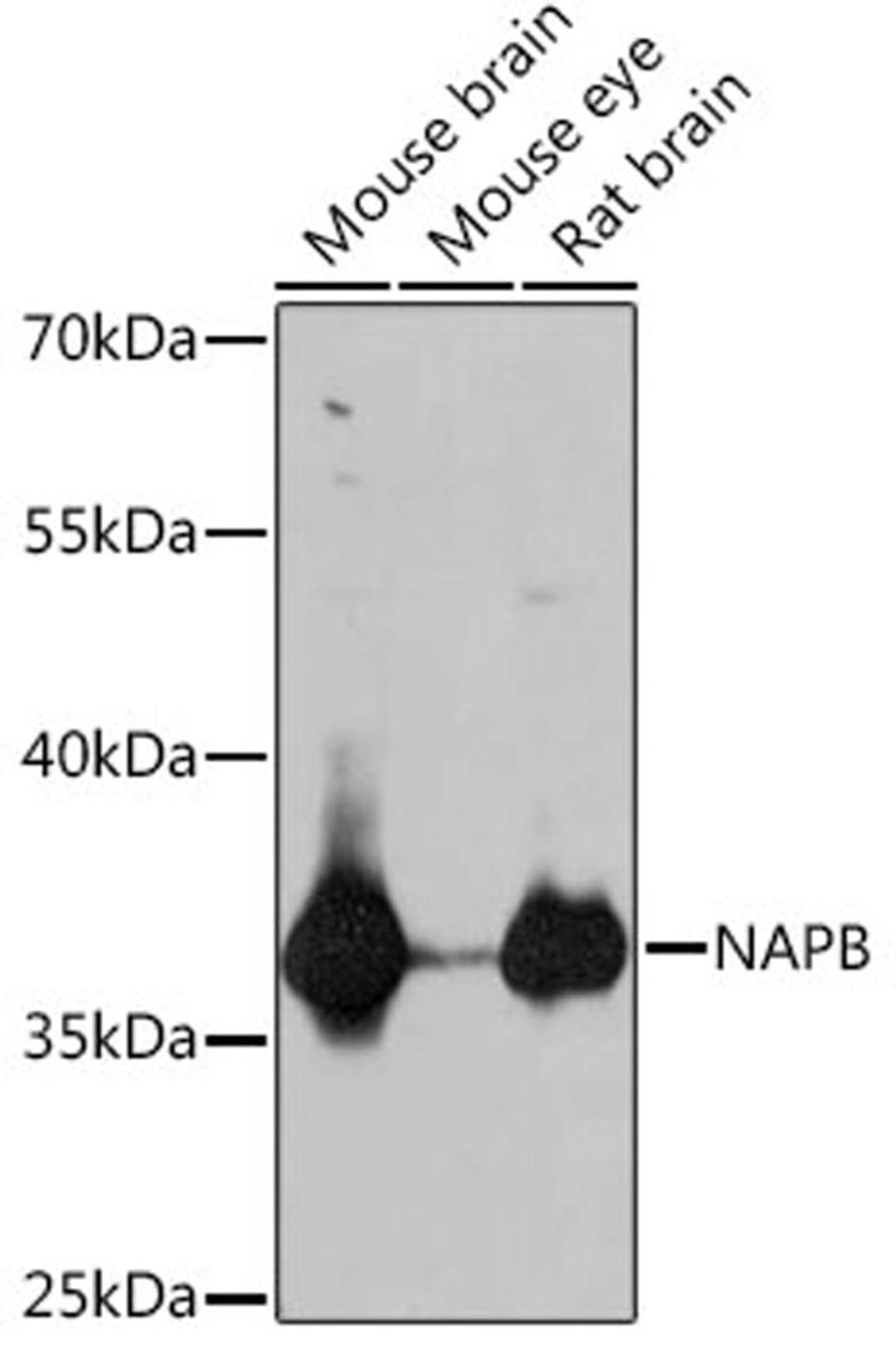 Western blot - NAPB antibody (A18223)