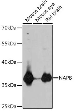 Western blot - NAPB antibody (A18223)