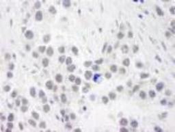 Immunohistochemistry-Paraffin: RPA70 Antibody [NB100-2204] - FFPE section of human seminoma.   Affinity purified rabbit anti-RPA70 used at a dilution of 1:250.