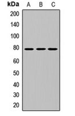 Western blot analysis of THP1 (Lane1), mouse kidney (Lane2), rat kidney (Lane3) whole cell lysates using NFKBIZ antibody