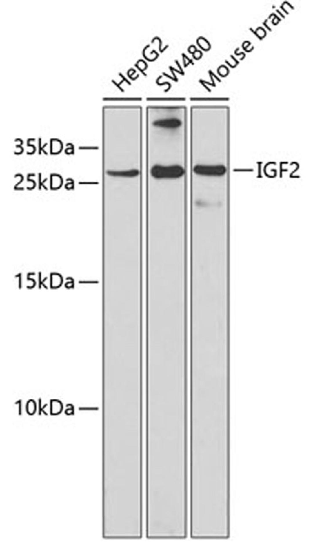 Western blot - IGF2 antibody (A2086)