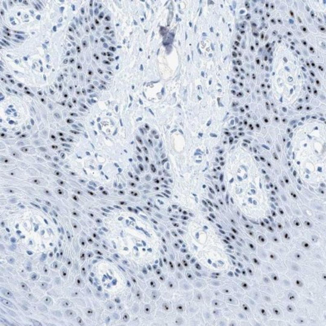 Immunohistochemistry: RNF152 Antibody [NBP2-31999] - Immunohistochemical staining of human vulva/anal skin shows strong nucleolar positivity in basal squamous epithelial cells.