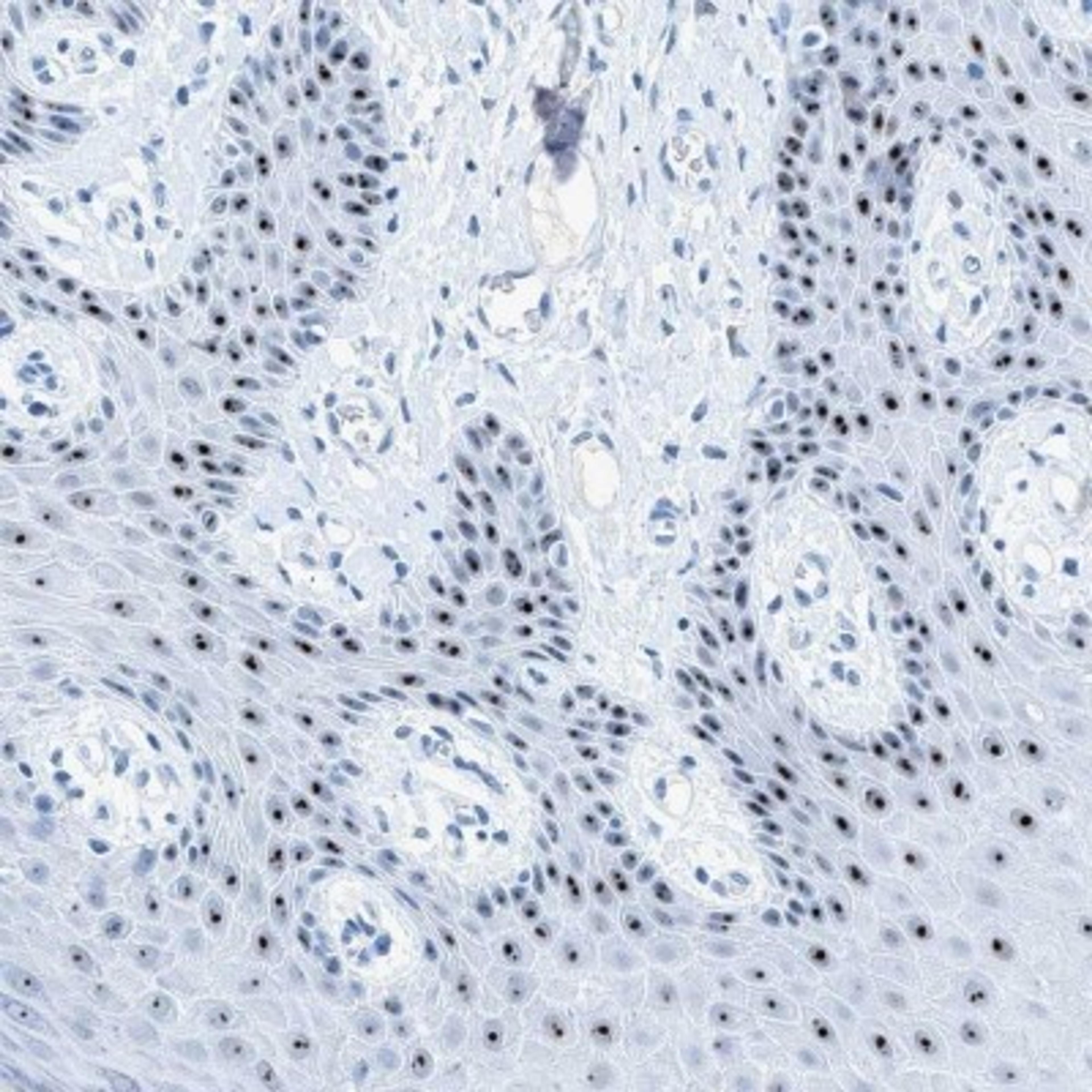 Immunohistochemistry: RNF152 Antibody [NBP2-31999] - Immunohistochemical staining of human vulva/anal skin shows strong nucleolar positivity in basal squamous epithelial cells.