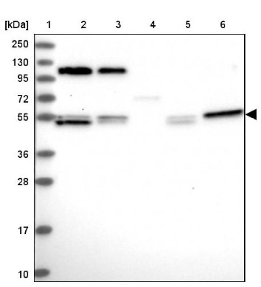 Western Blot: CCDC8 Antibody [NBP1-85085] - Lane 1: Marker [kDa] 250, 130, 95, 72, 55, 36, 28, 17, 10<br/>Lane 2: Human cell line RT-4<br/>Lane 3: Human cell line U-251MG sp<br/>Lane 4: Human plasma (IgG/HSA depleted)<br/>Lane 5: Human liver tissue<br/>Lane 6: Human tonsil tissue