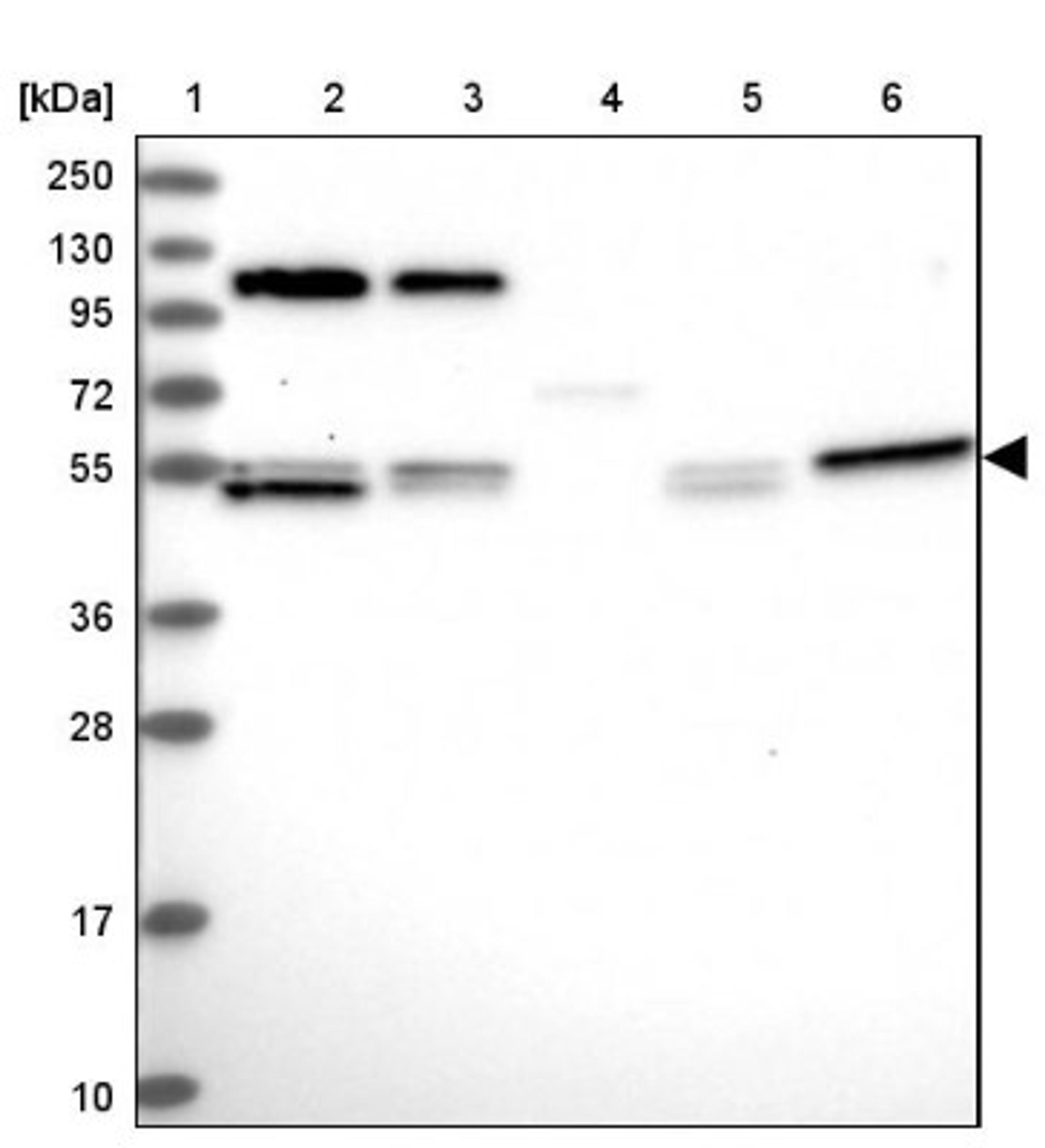 Western Blot: CCDC8 Antibody [NBP1-85085] - Lane 1: Marker [kDa] 250, 130, 95, 72, 55, 36, 28, 17, 10<br/>Lane 2: Human cell line RT-4<br/>Lane 3: Human cell line U-251MG sp<br/>Lane 4: Human plasma (IgG/HSA depleted)<br/>Lane 5: Human liver tissue<br/>Lane 6: Human tonsil tissue