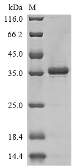 (Tris-Glycine gel) Discontinuous SDS-PAGE (reduced) with 5% enrichment gel and 15% separation gel.