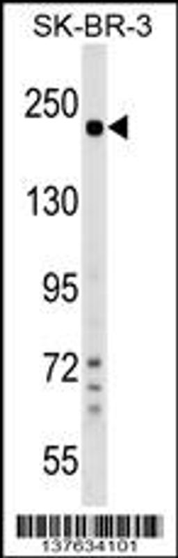 Western blot analysis in SK-BR-3 cell line lysates (35ug/lane).