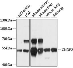 Western blot - CNDP2 antibody (A10381)