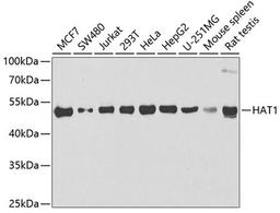 Western blot - HAT1 antibody (A6188)