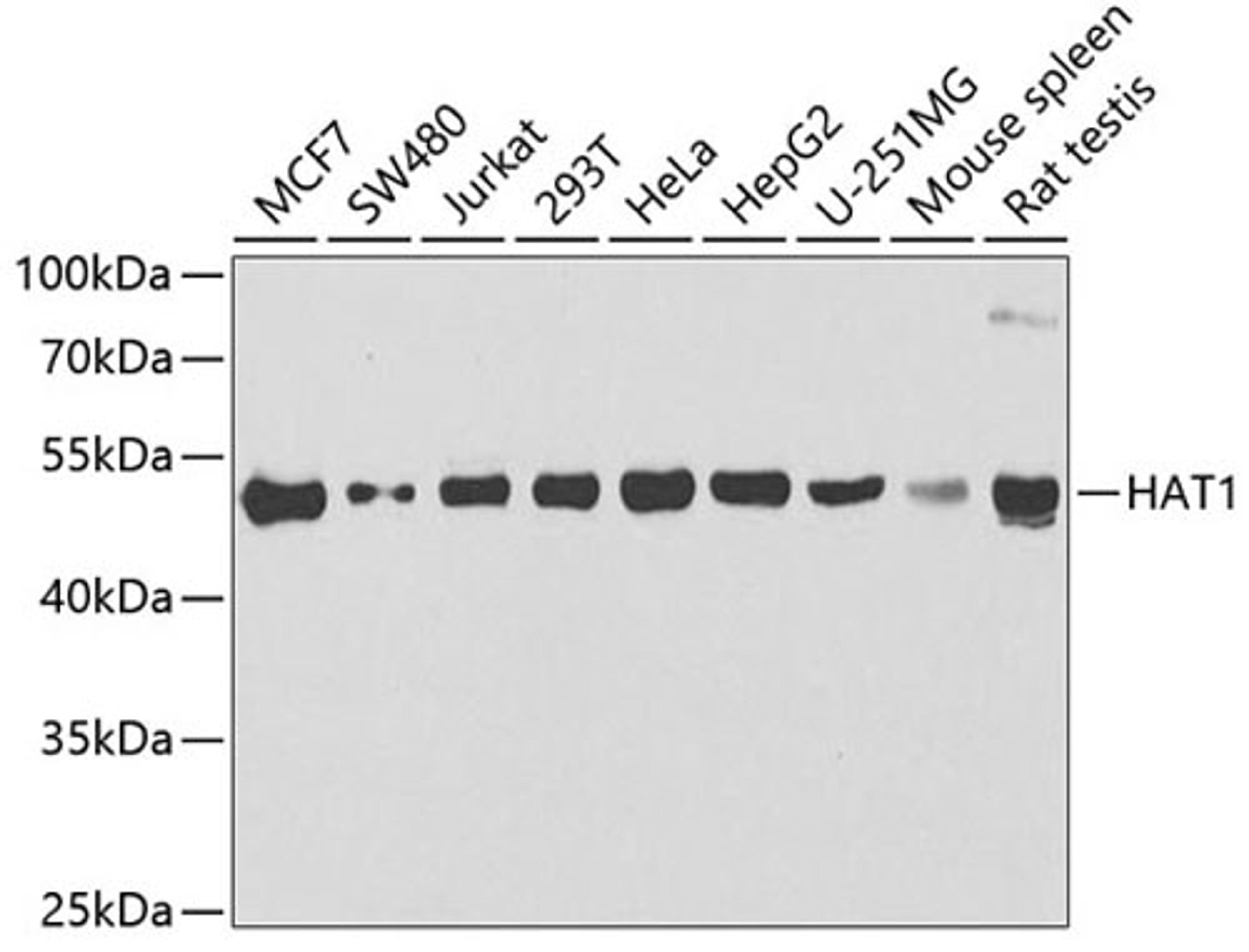 Western blot - HAT1 antibody (A6188)