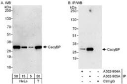 Detection of human CacyBP by western blot and immunoprecipitation.