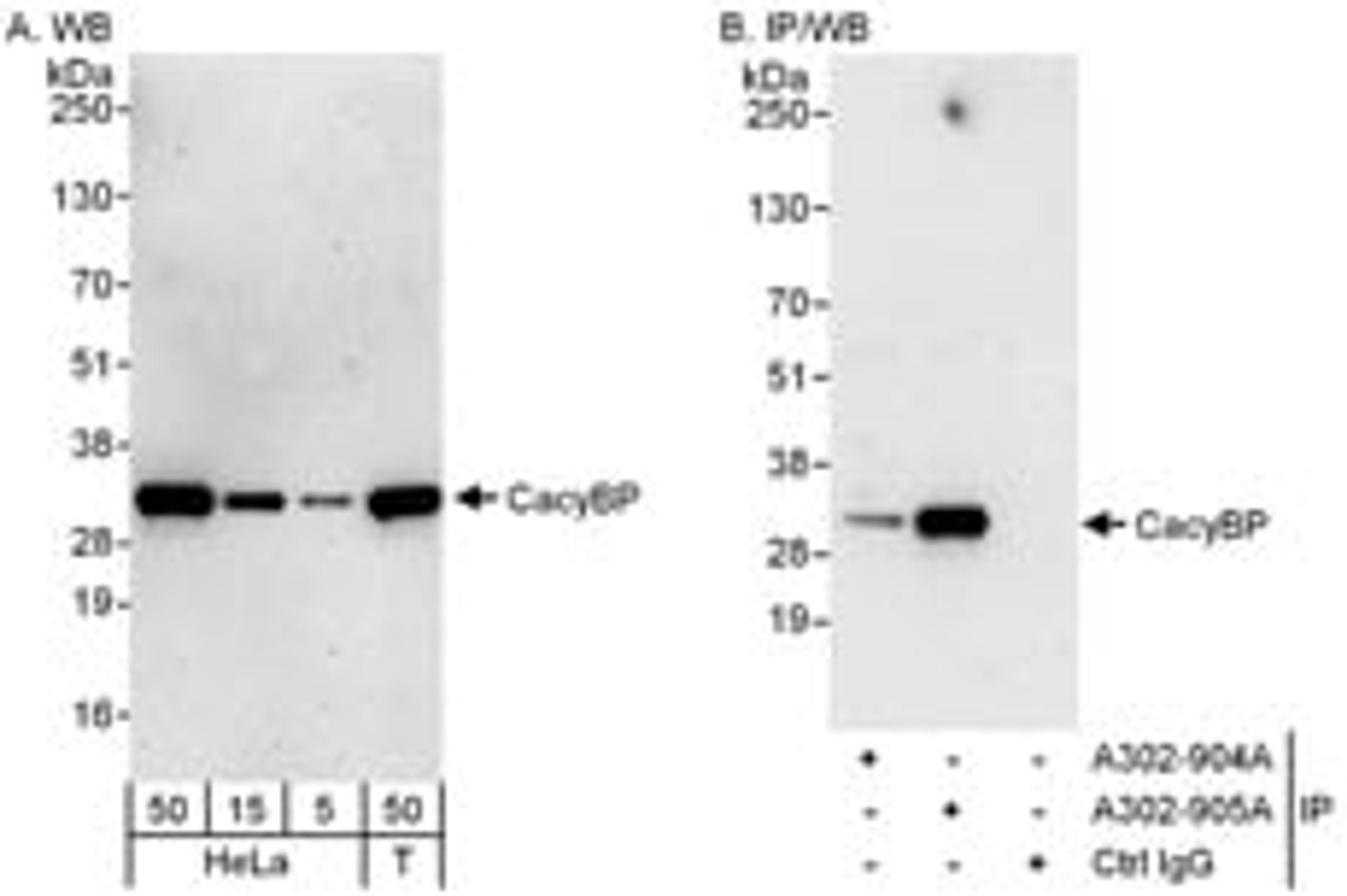 Detection of human CacyBP by western blot and immunoprecipitation.