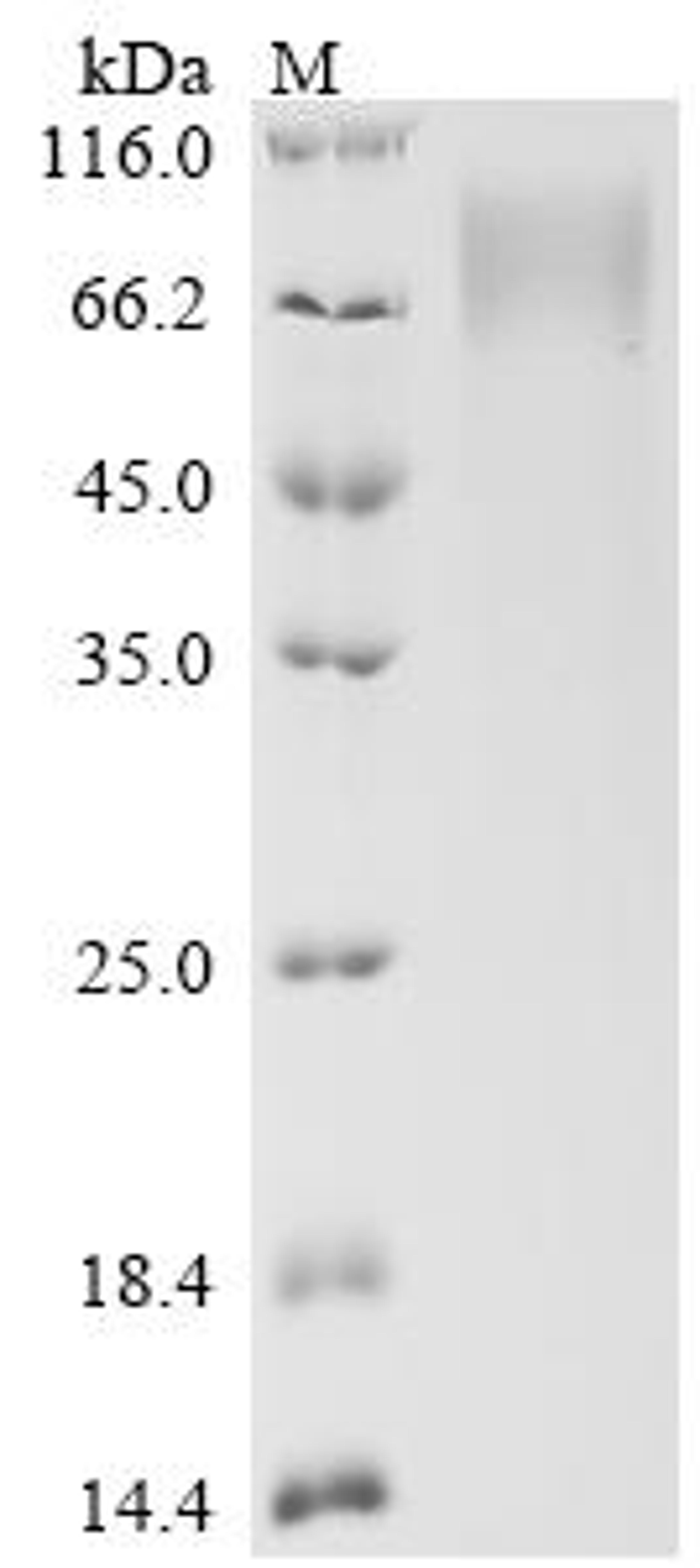 (Tris-Glycine gel) Discontinuous SDS-PAGE (reduced) with 5% enrichment gel and 15% separation gel.