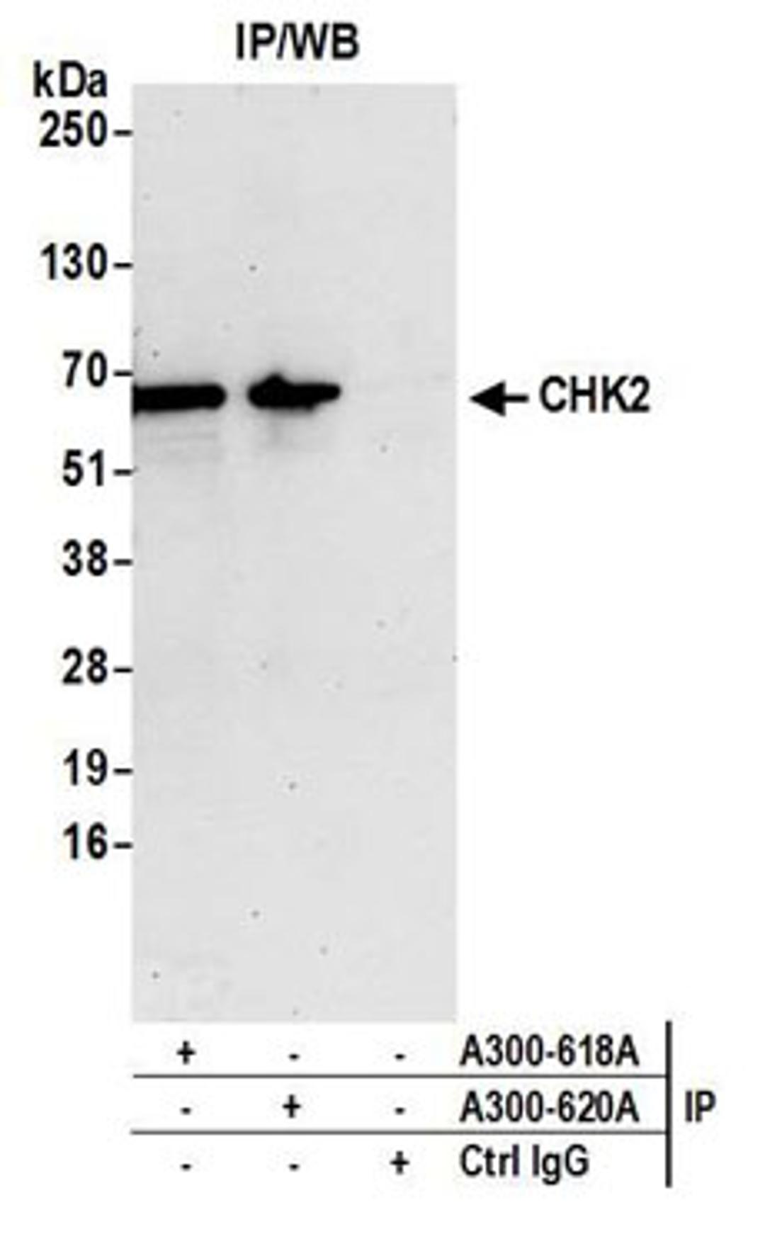 Detection of human CHK2 by western blot of immunoprecipitates.