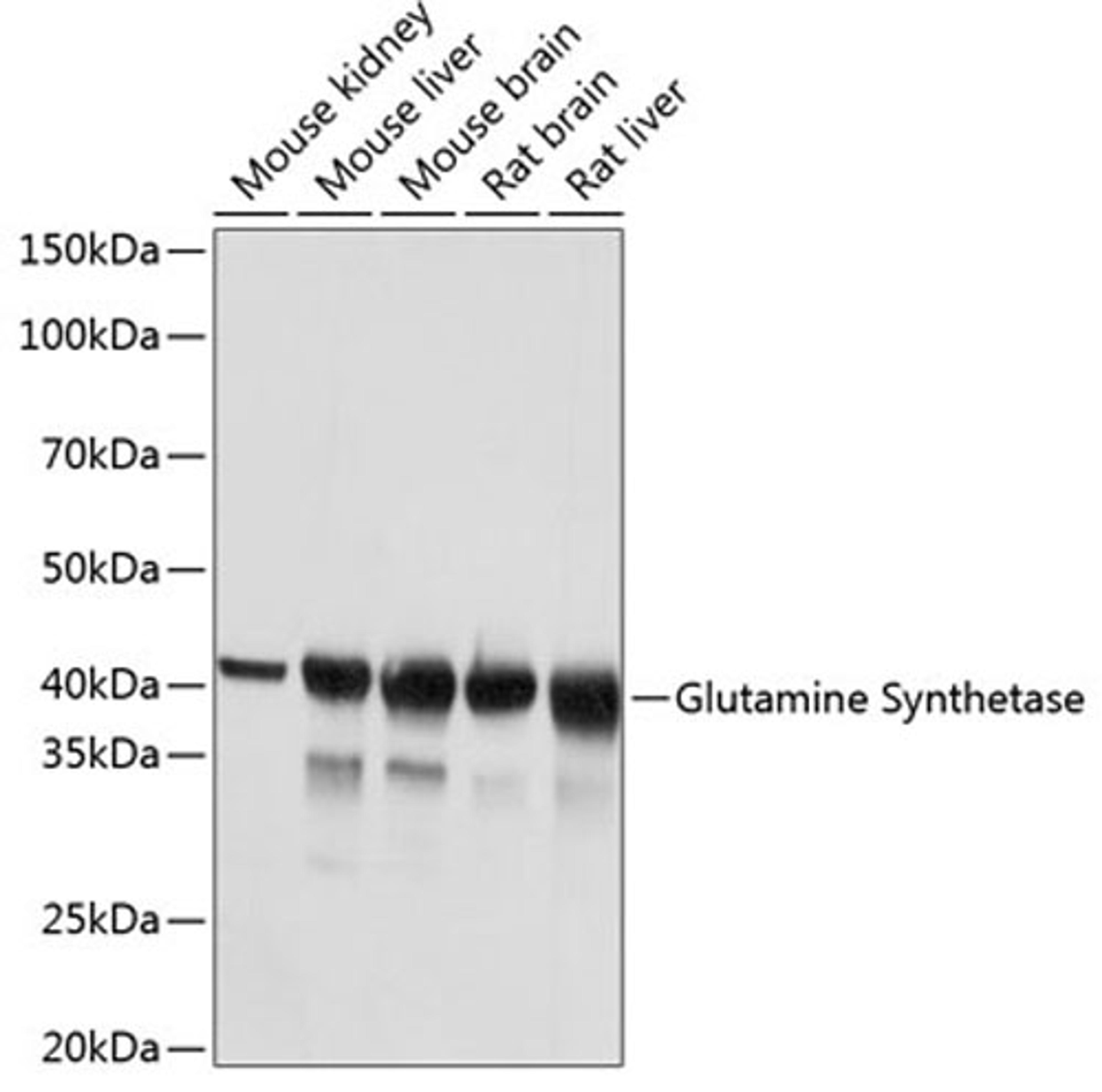 Western blot - Glutamine Synthetase antibody (A19641)