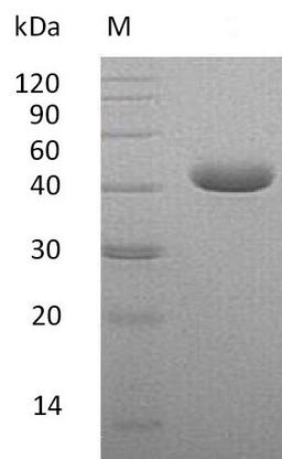 (Tris-Glycine gel) Discontinuous SDS-PAGE (reduced) with 5% enrichment gel and 15% separation gel.