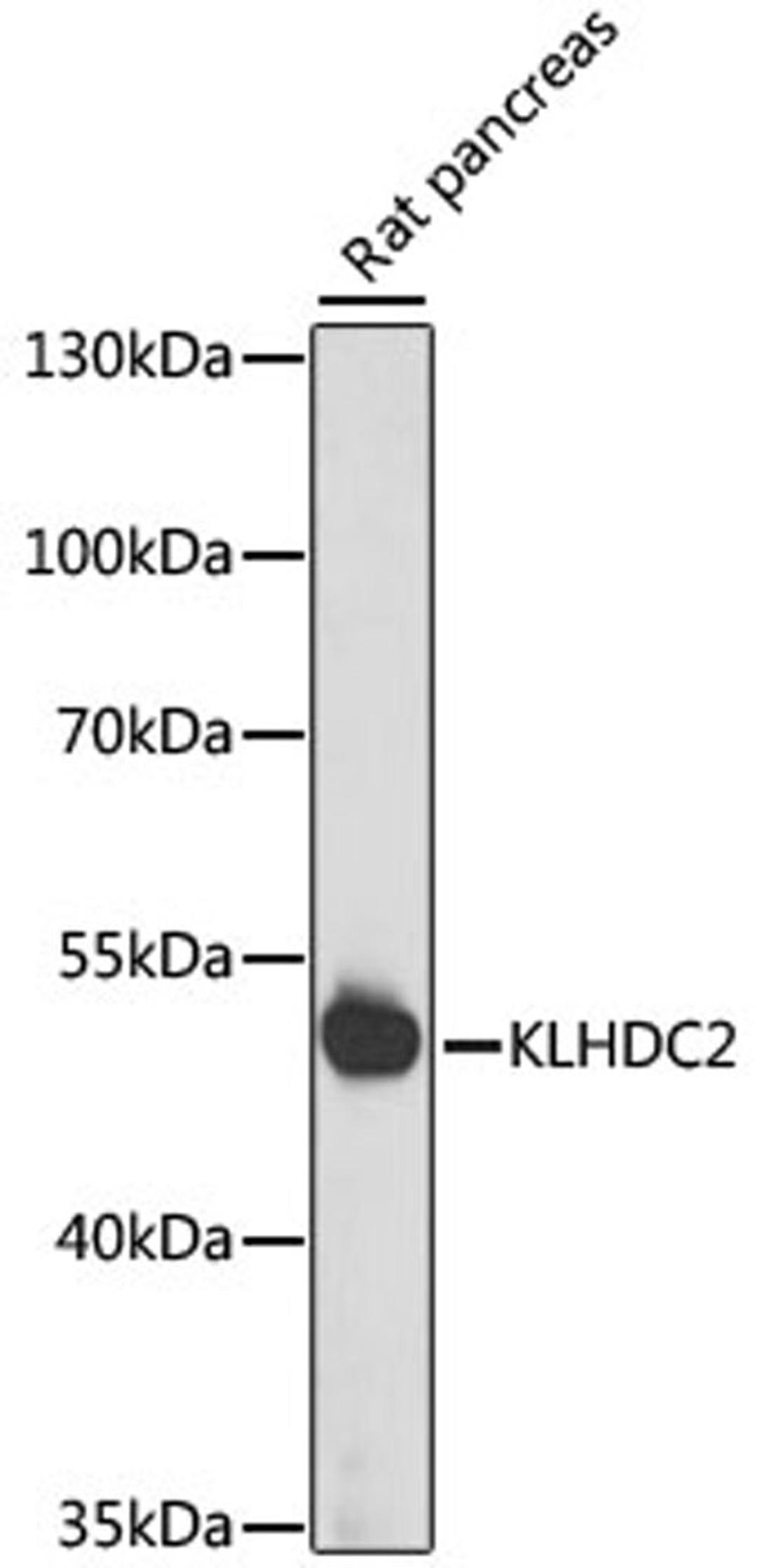 Western blot - KLHDC2 antibody (A15147)