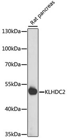 Western blot - KLHDC2 antibody (A15147)