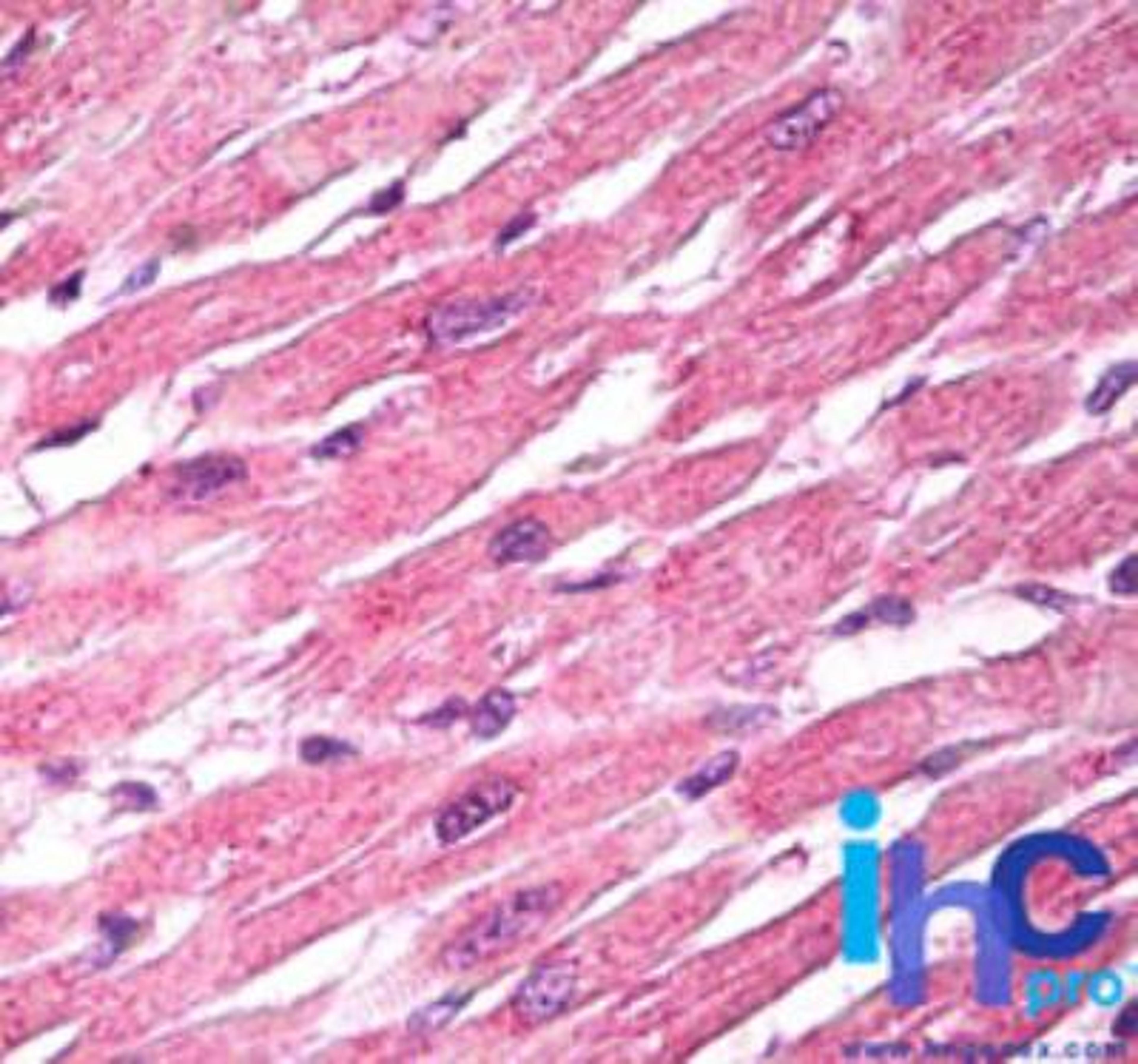 Immunohistochemistry-Paraffin: Laforin Antibody [NBP2-24474] - Formalin-fixed, paraffin-embedded human heart stained with EPM2A antibody at 10 ug/ml. Staining of formalin-fixed tissues is enhanced by boiling tissue sections in 10 mM sodium citrate buffer, pH 6.0 for 10-20 min followed by cooling at RT for 20 min.