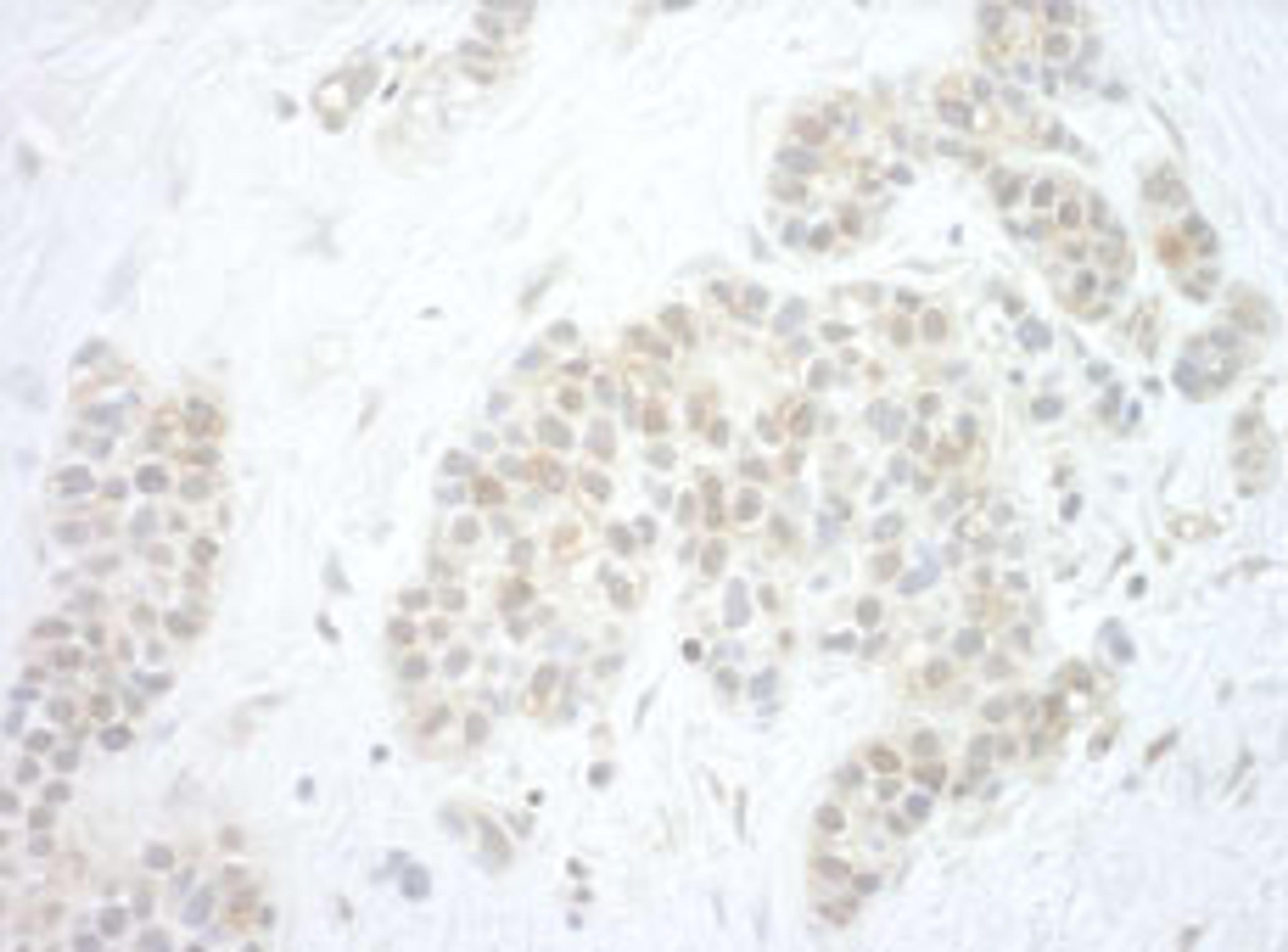 Detection of human Pygo2 by immunohistochemistry.