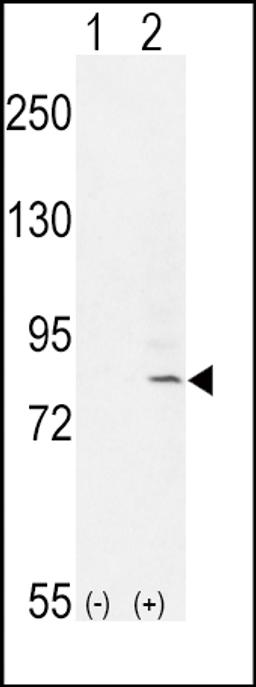 Western blot analysis of FGFR1 using rabbit polyclonal FGFR1-Y307 using 293 cell lysates (2 ug/lane) either nontransfected (Lane 1) or transiently transfected with the FGFR1 gene (Lane 2).