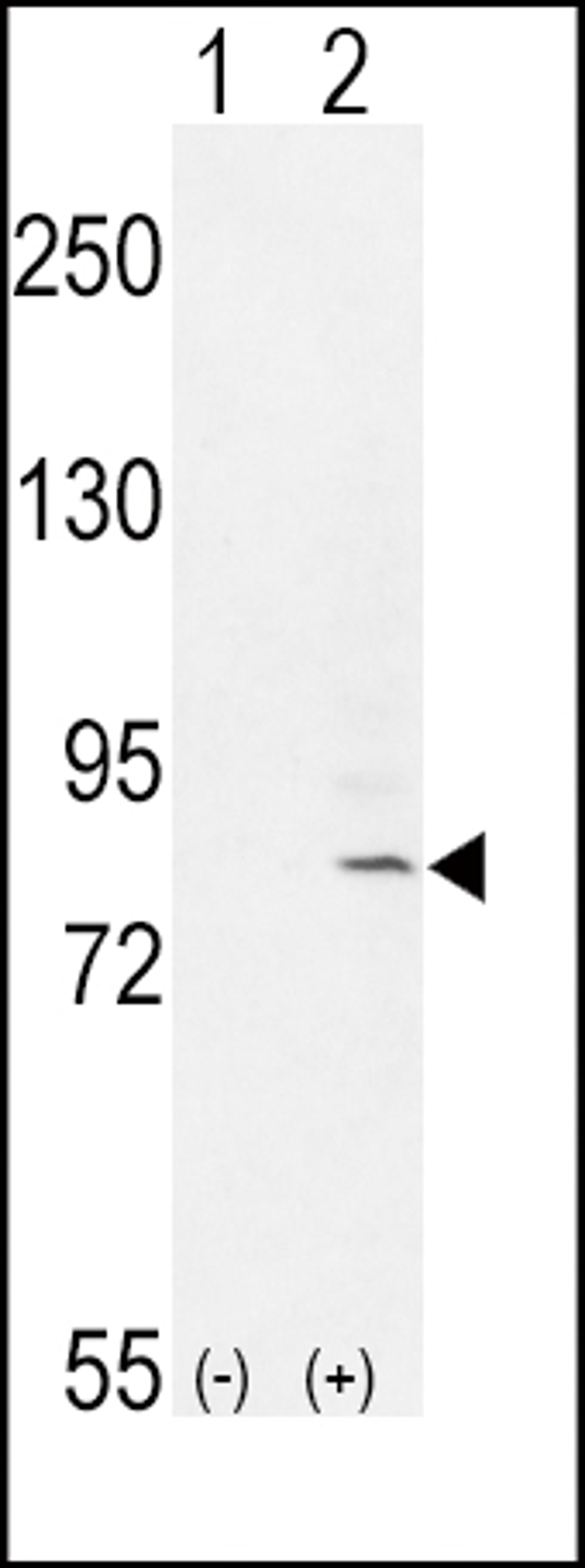 Western blot analysis of FGFR1 using rabbit polyclonal FGFR1-Y307 using 293 cell lysates (2 ug/lane) either nontransfected (Lane 1) or transiently transfected with the FGFR1 gene (Lane 2).