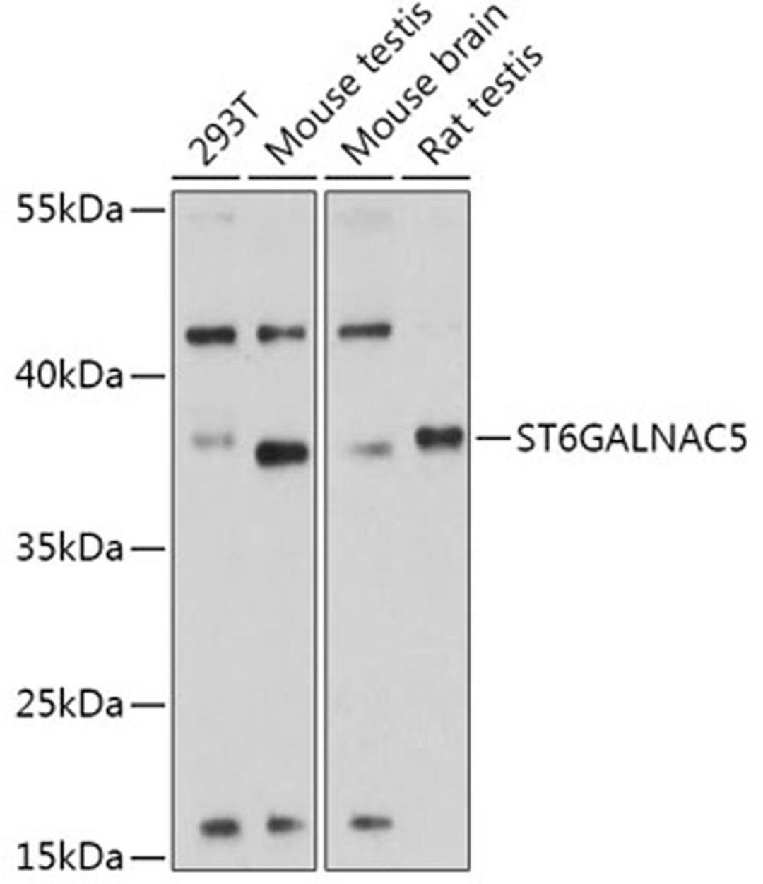 Western blot - ST6GALNAC5 antibody (A17782)