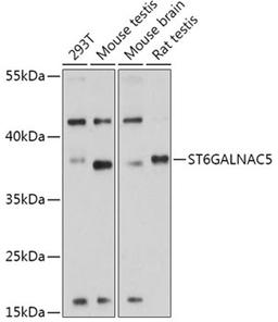 Western blot - ST6GALNAC5 antibody (A17782)