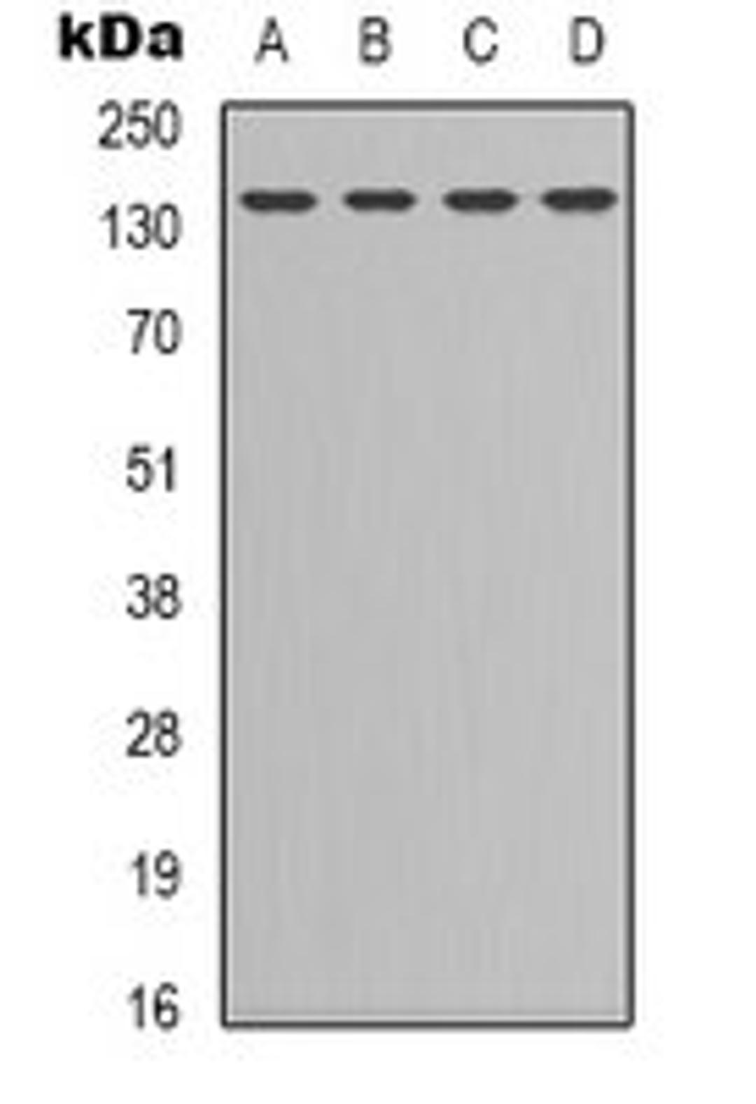 Western blot analysis of HEK293T (Lane 1), K562 (Lane 2), NIH3T3 (Lane 3), COLO205 (Lane 4) whole cell lysates using CD295 antibody