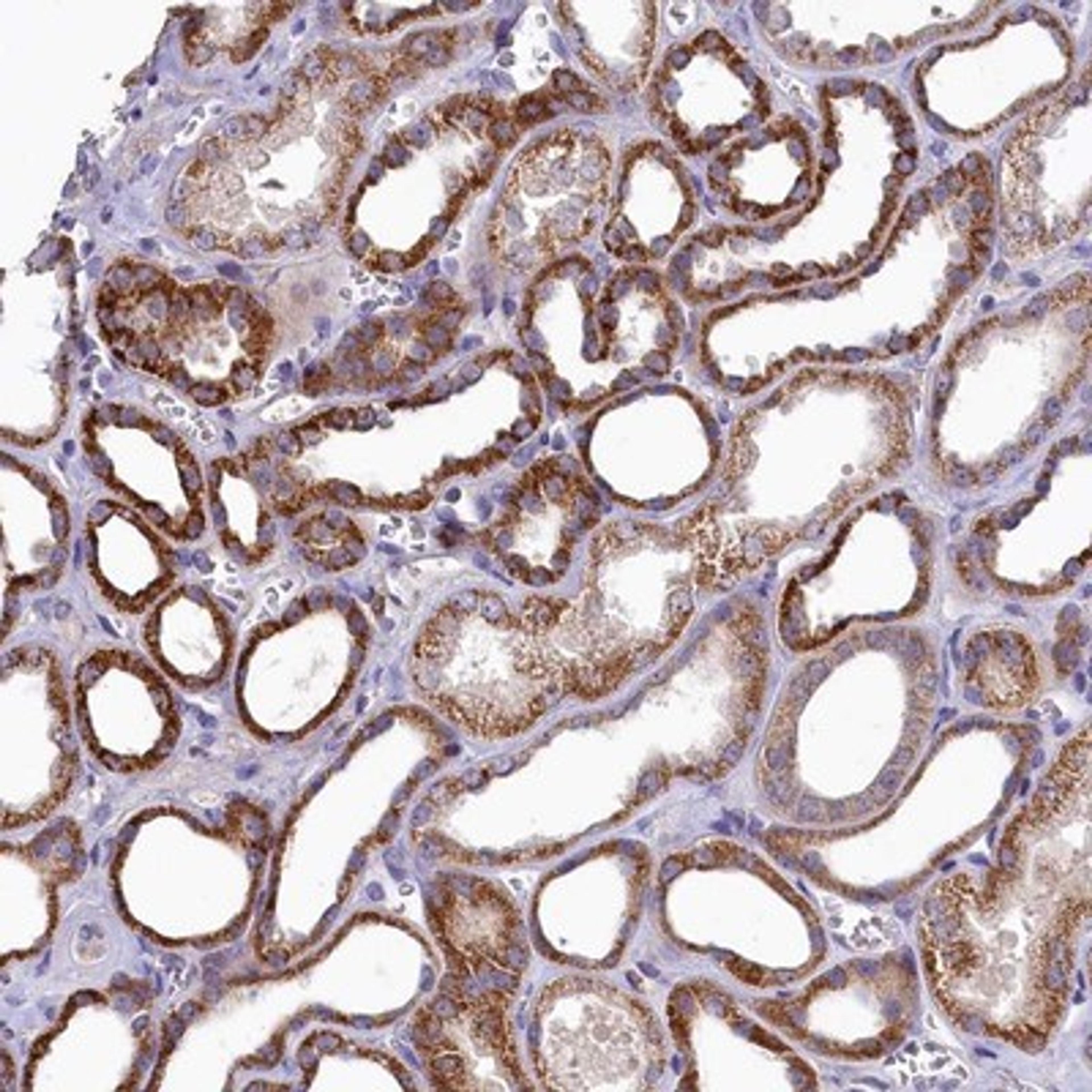 Immunohistochemistry-Paraffin: DENND4B Antibody [NBP1-93633] - Staining of human kidney shows strong cytoplasmic positivity in cells in tubules.