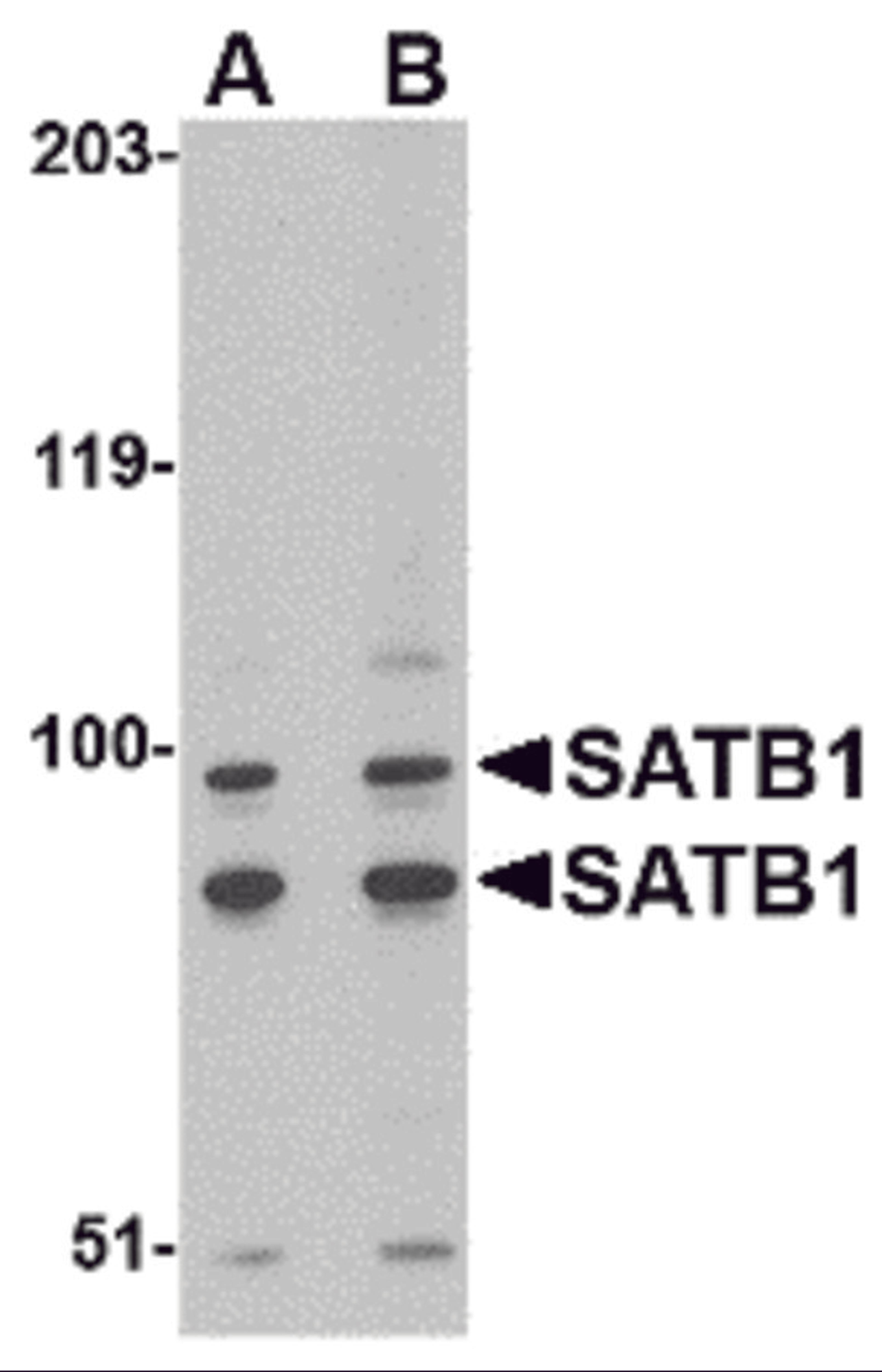 Western blot analysis of SATB1 in A20 cell lysate with SATB1 antibody at (A) 2 and (B) 4 &#956;g/mL.