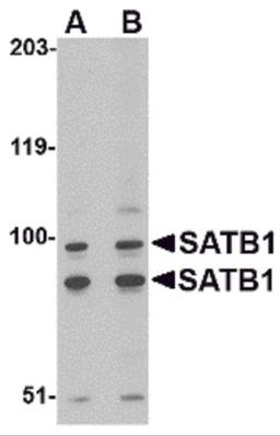 Western blot analysis of SATB1 in A20 cell lysate with SATB1 antibody at (A) 2 and (B) 4 μg/mL.
