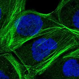 Immunocytochemistry/Immunofluorescence: HMX2 Antibody [NBP1-91997] - Staining of human cell line A-431 shows positivity in cytoskeleton (actin filaments).