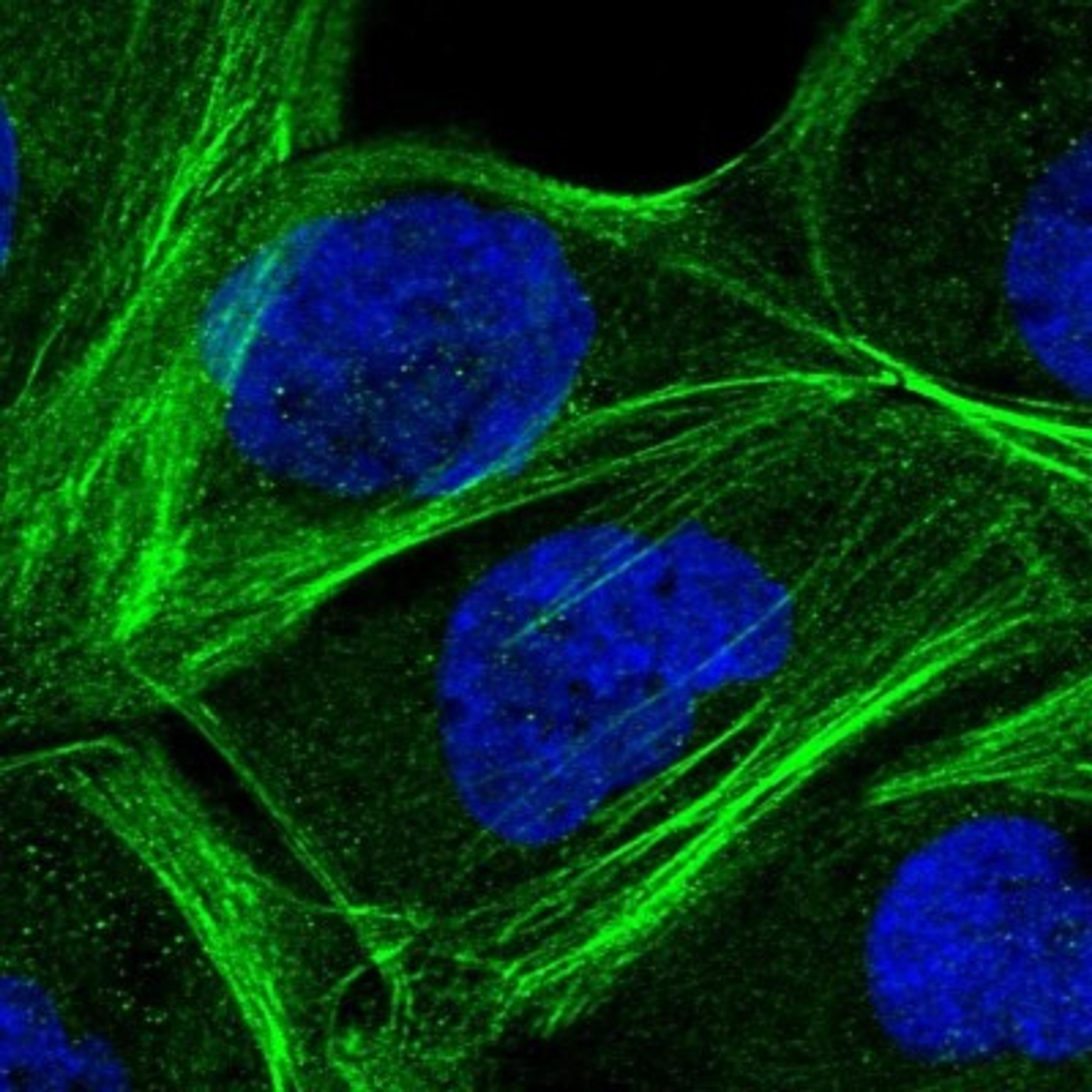 Immunocytochemistry/Immunofluorescence: HMX2 Antibody [NBP1-91997] - Staining of human cell line A-431 shows positivity in cytoskeleton (actin filaments).