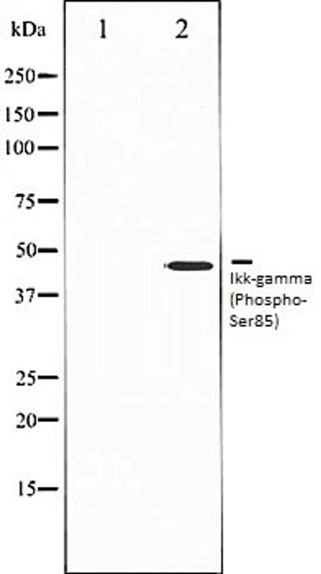 Western blot analysis of HepG2 whole cell lysates using IKK-? (Phospho-Ser85) antibody, The lane on the left is treated with the antigen-specific peptide.