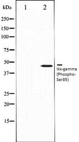 Western blot analysis of HepG2 whole cell lysates using IKK-? (Phospho-Ser85) antibody, The lane on the left is treated with the antigen-specific peptide.