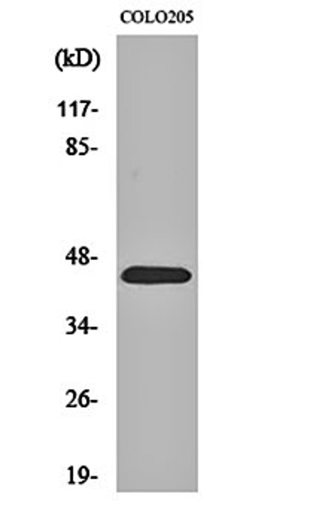 Western blot analysis of COLO205 cell lysates using PKR1 antibody