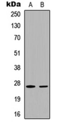 Western blot analysis of HeLa (Lane 1), MCF7 (Lane 2) whole cell lysates using p27 Kip1 (phospho-T187) antibody