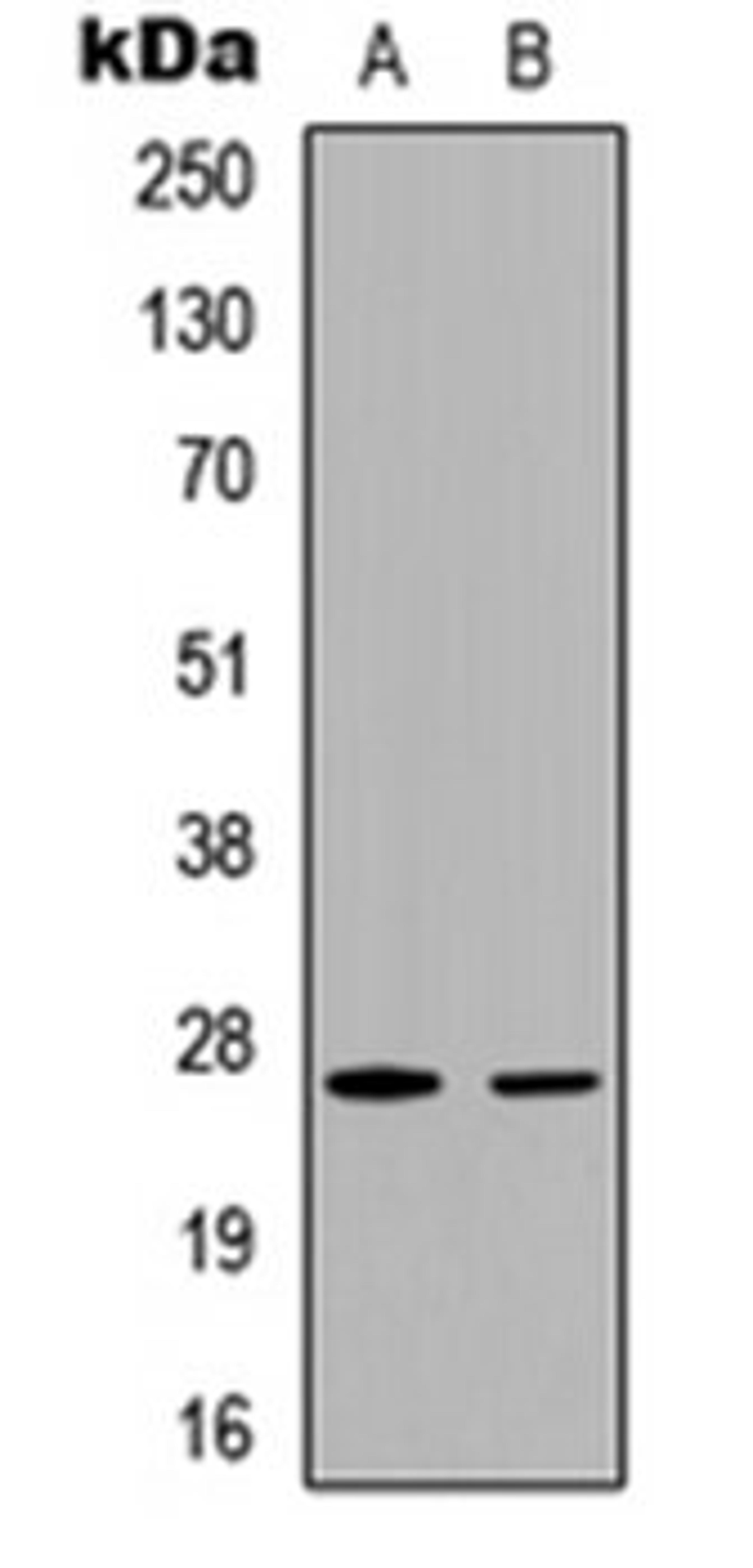 Western blot analysis of HeLa (Lane 1), MCF7 (Lane 2) whole cell lysates using p27 Kip1 (phospho-T187) antibody