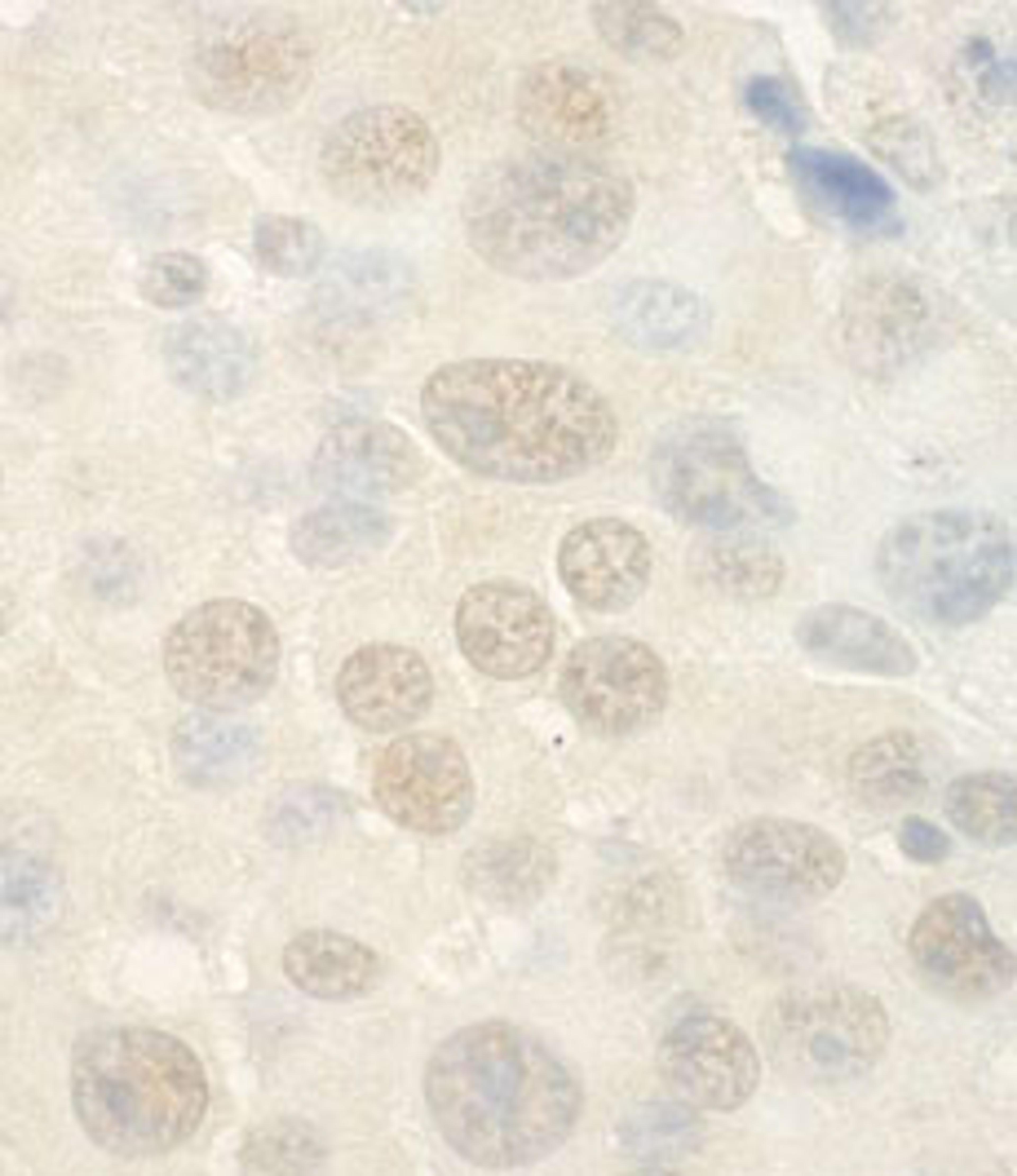 Detection of mouse WDR5 by immunohistochemistry.