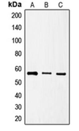 Western blot analysis of HeLa (Lane 1), HT1080 (Lane 2), NIH3T3 (Lane 3) whole cell lysates using SRSF4 antibody