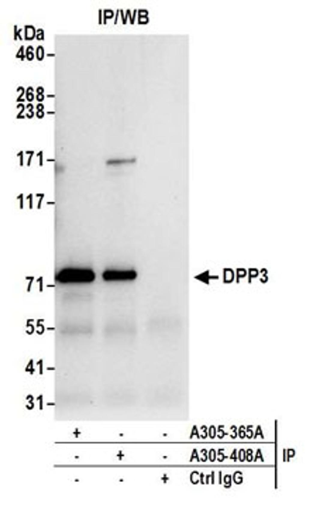 Detection of human DPP3 by western blot of immunoprecipitates.