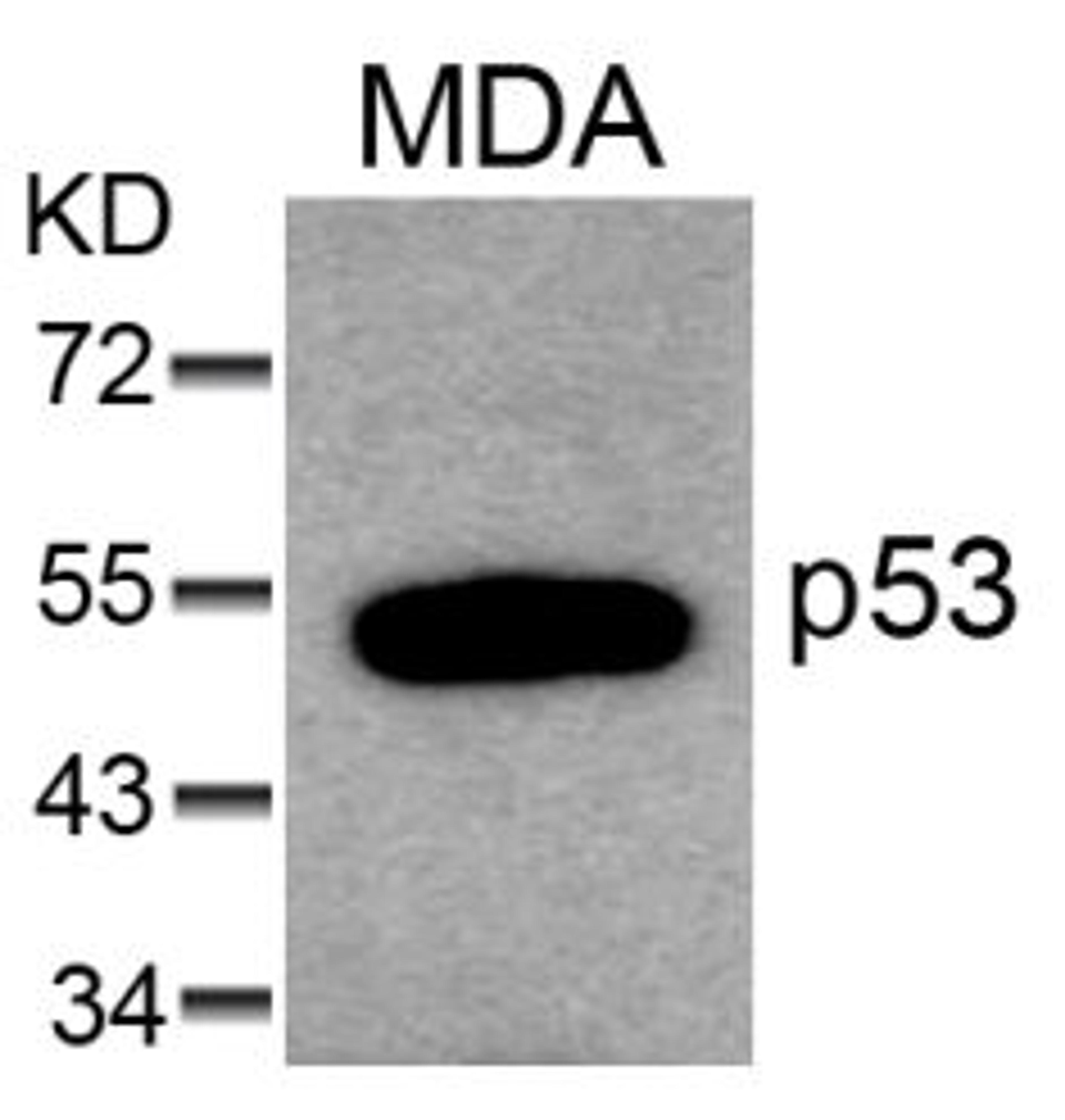 Western blot analysis of lysed extracts from MDA cells using p53 (Ab-6).