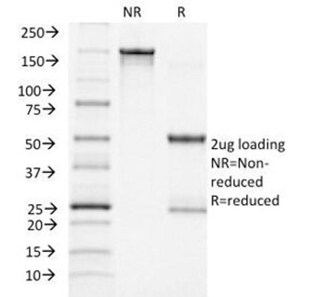 SDS-PAGE Analysis of Purified, BSA-Free ACTH Antibody (clone CLIP/1418). Confirmation of Integrity and Purity of the Antibody.